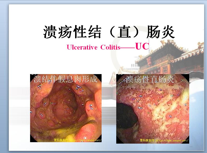 长治久安,肠治久安哪一个字错了