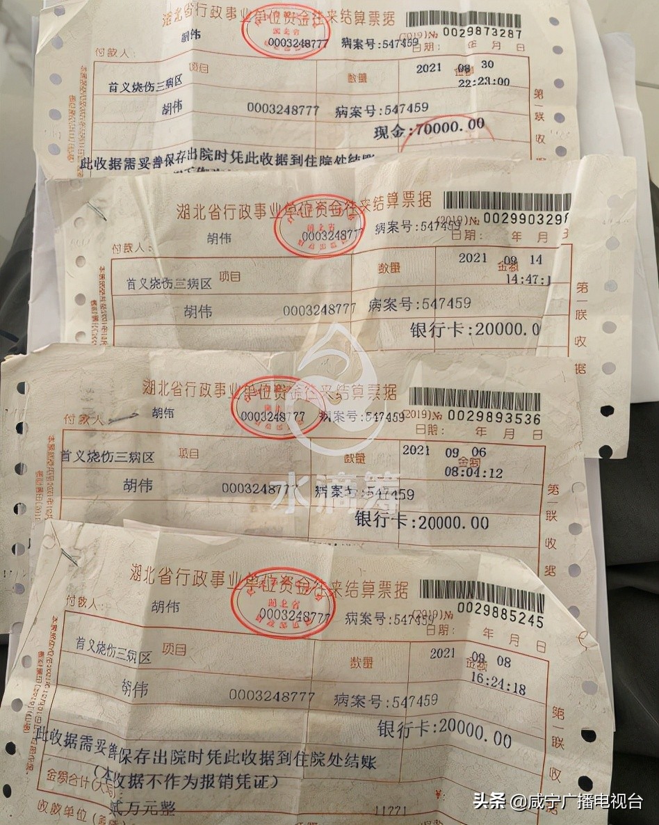 帮帮他!咸安星星村小伙全身烧伤40%恳请社会救助