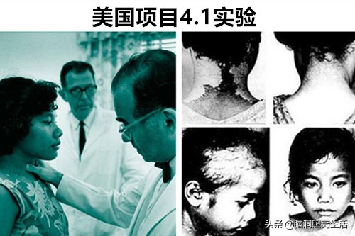 十大灭绝人性的人体实验,历史上最恐怖五项人体实验