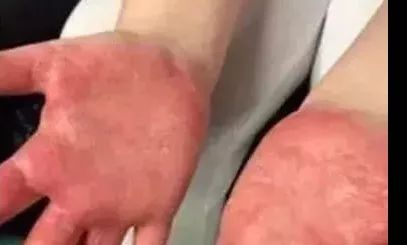 德州紧急提醒,孩子玩的“水晶泥”内含致命毒硼砂