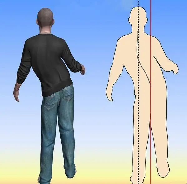 56岁男子深夜脑出血,提醒:这把年纪了,怎么还做这2件事