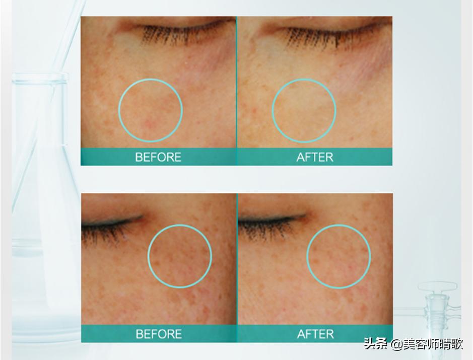 小银瓶淡斑精华推荐,美白淡斑小白瓶精华