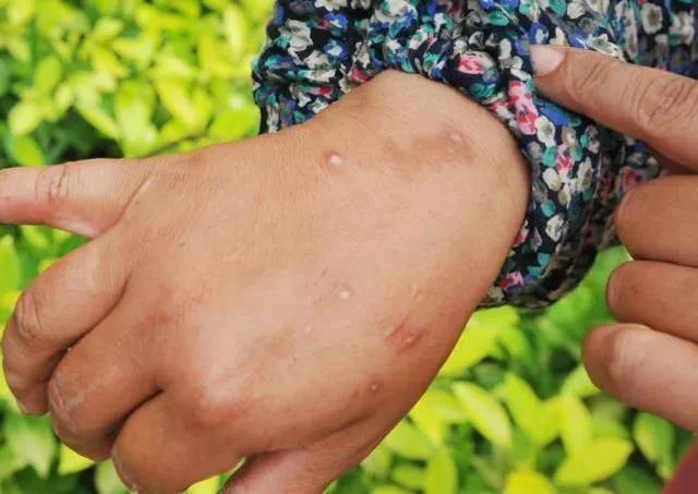 红火蚁列入全球最危险入侵物种,红火蚁位列最危险入侵物种是什么