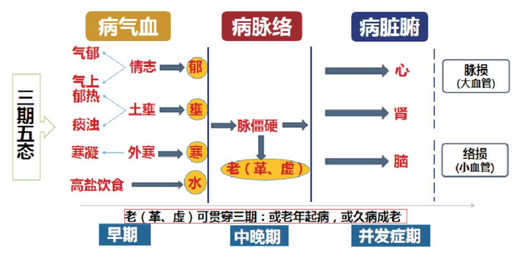 仝小林高血压经验,仝小林高血压验方