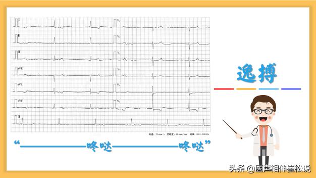 心脏停跳10秒是什么原因引起的,心跳慢心跳骤停怎么办