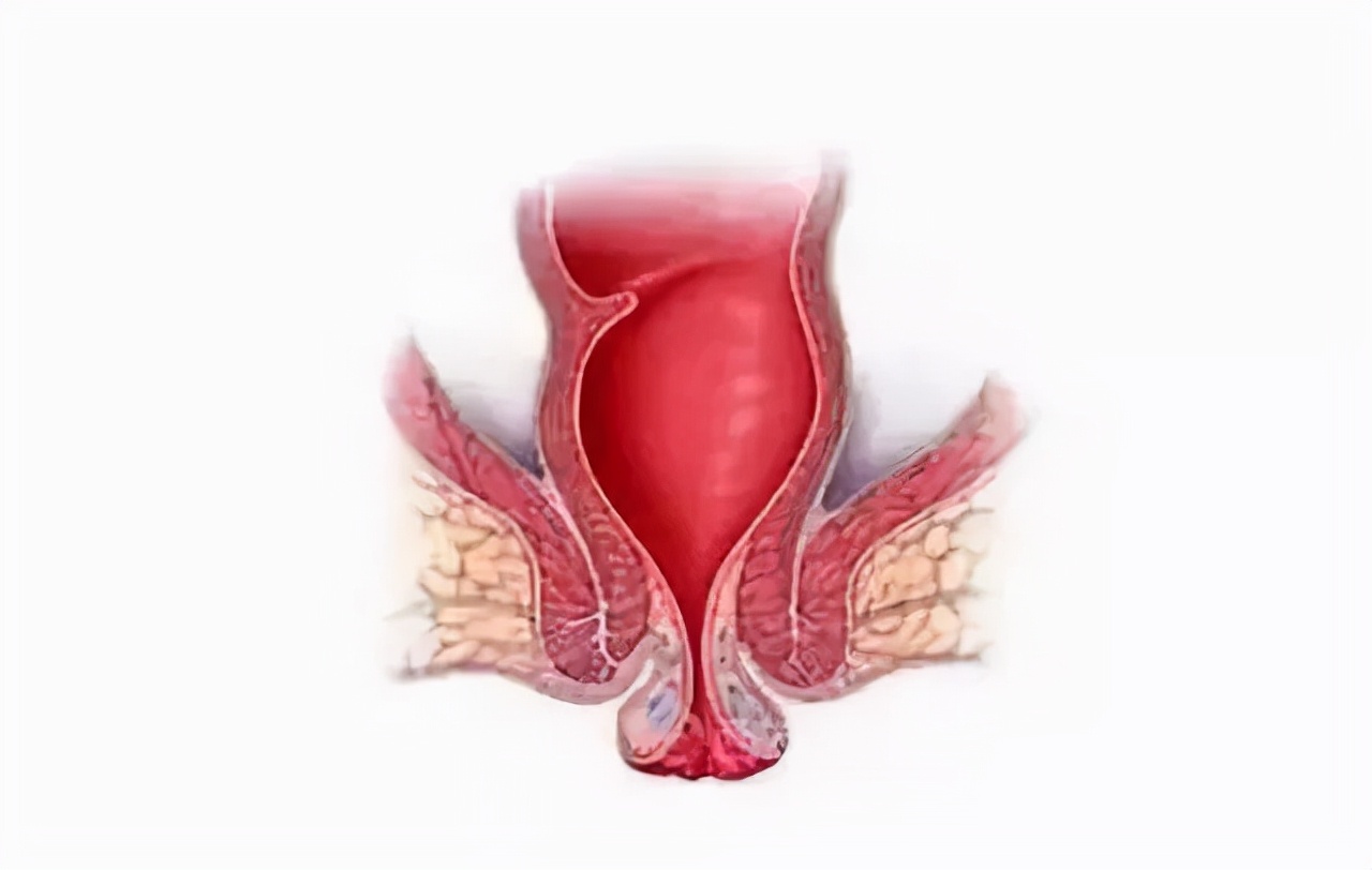 屁股里总感觉夹了个东西怎么办,肛门坠胀是焦虑引起的躯体症状吗