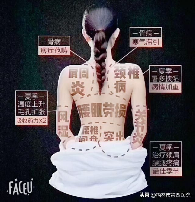 榆林市星元医院“冬病夏治”贴敷治疗项目正式启动