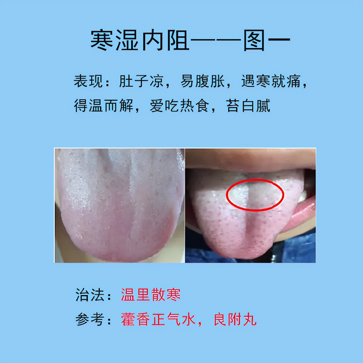 根据舌象判断用哪种调理脾胃的药,脾胃常见的症状