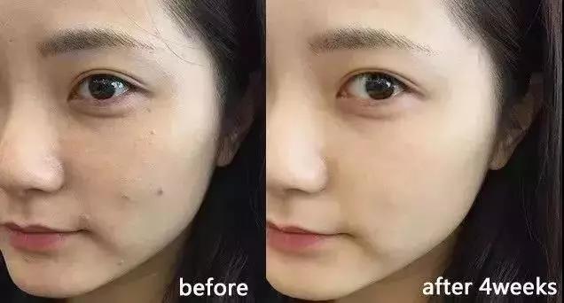 超临界蜂胶与普通蜂胶有几大优点,纯天然蜂胶的作用与功效