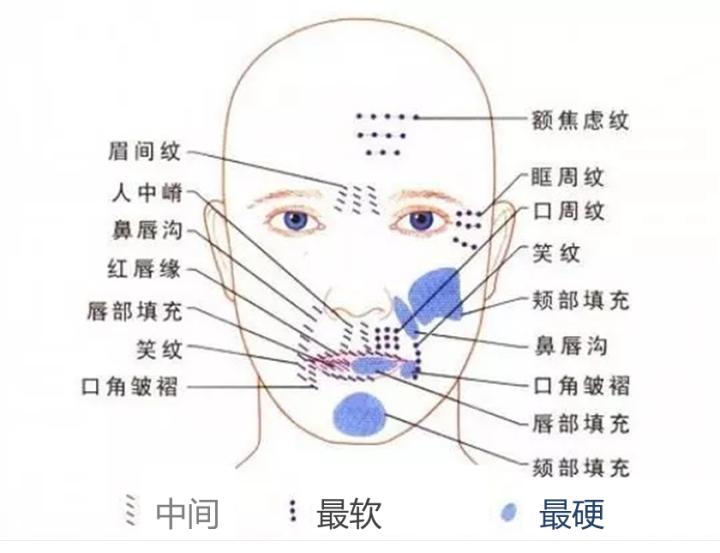 张歆艺用的什么填充脸部,张歆艺填充脸部前后对比