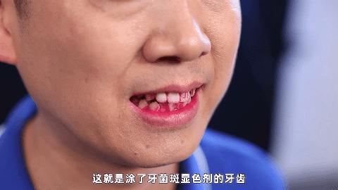 能把牙齿刷得很干净的电动牙刷,电动牙刷真的比普通牙刷的干净