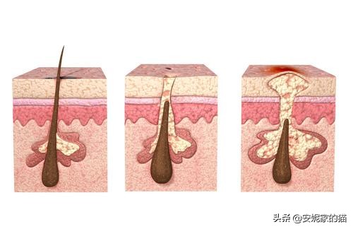 皮肤一摸就跟鸡皮一样,脸上出现鸡皮肤和小红点