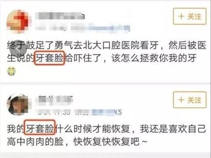龅牙矫正牙套脸,牙套可以矫正脸歪吗