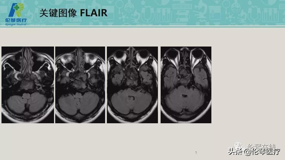 上海教授詹松华,上海曙光医院詹松华简介