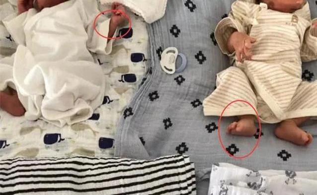 双胞胎两个爹亲子鉴定结果,双胞胎亲子鉴定一个不是亲生