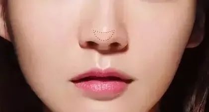 鼻头为什么会越捏越大,鼻头越缩越大是什么原因