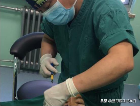 自体脂肪丰太阳穴多久才能恢复,自体脂肪丰太阳穴多久恢复正常