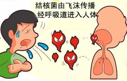 结核通俗讲什么意思,结核概述