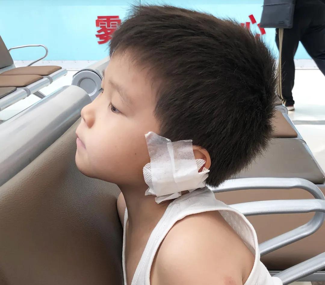 小孩耳垂根部裂开一道口子,孩子耳垂裂开了一条缝