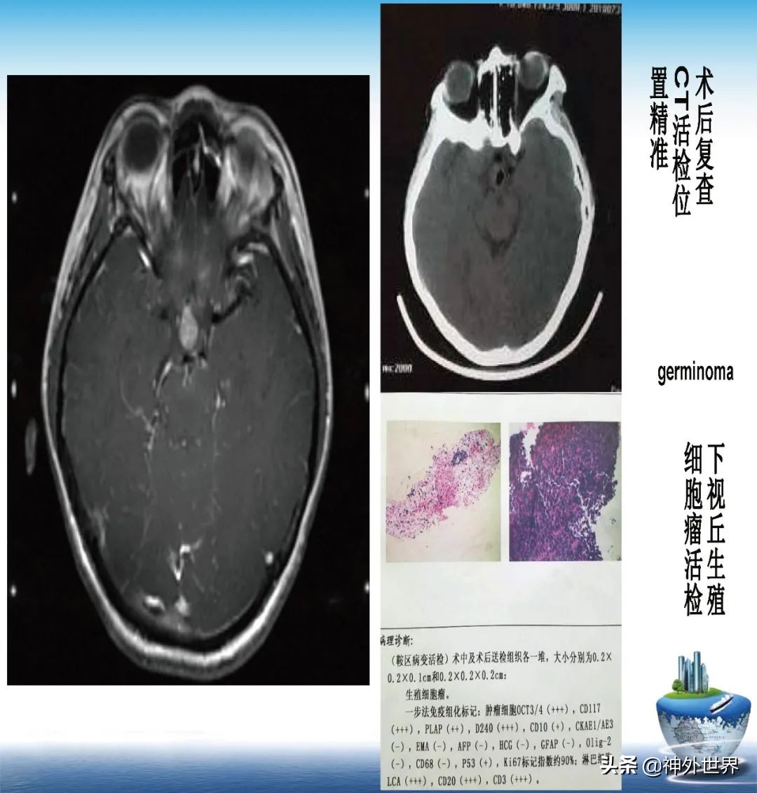 宣武医院神经外科王亚明祖籍,北京宣武医院神经科专家王亚明