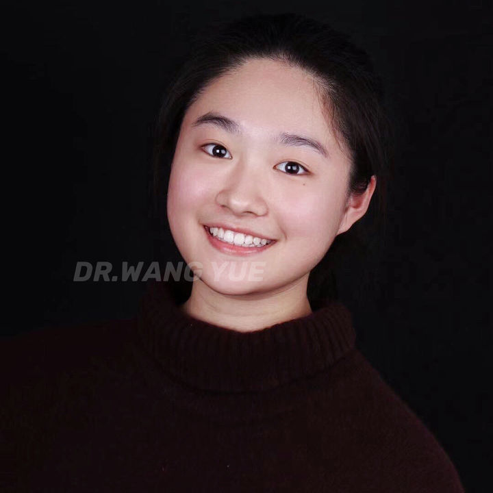 从新一代金庸女神文咏珊看正畸美学中的微笑｜上海牙齿矫正