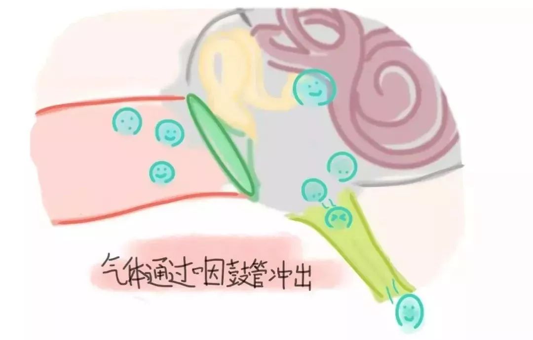 坐飞机耳朵堵了怎么快速通气妙招,坐飞机感觉耳朵里面跟堵住了一样