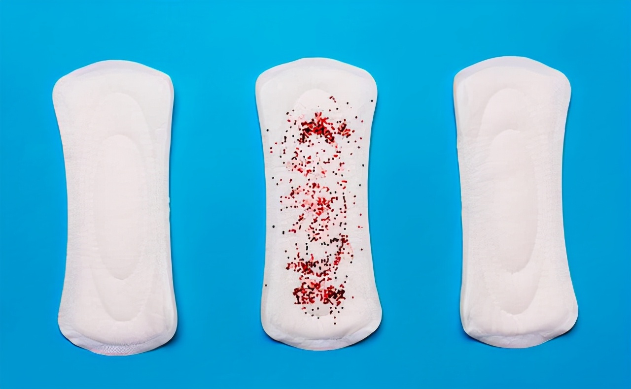 月经结束后十天褐色鼻涕状分泌物,月经结束后2天又出血褐色分泌物