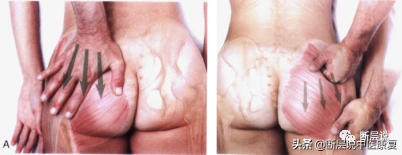 怎么缓解腰引起的臀部疼痛,怎样治疗腰痛和臀部肌肉疼痛