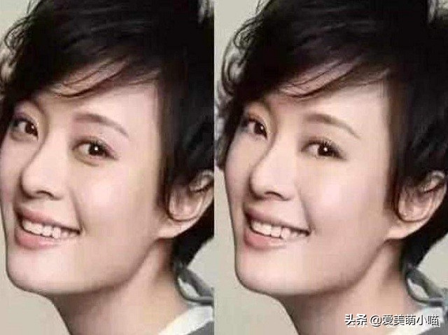 一张图分清散光和近视,眼袋和卧蚕的区分方法