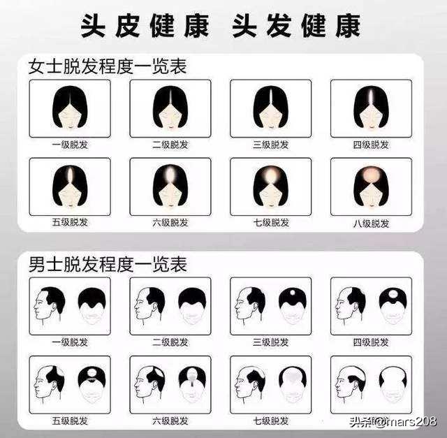 保卫发际线,防脱路上的13款防脱洗护用品使用感受