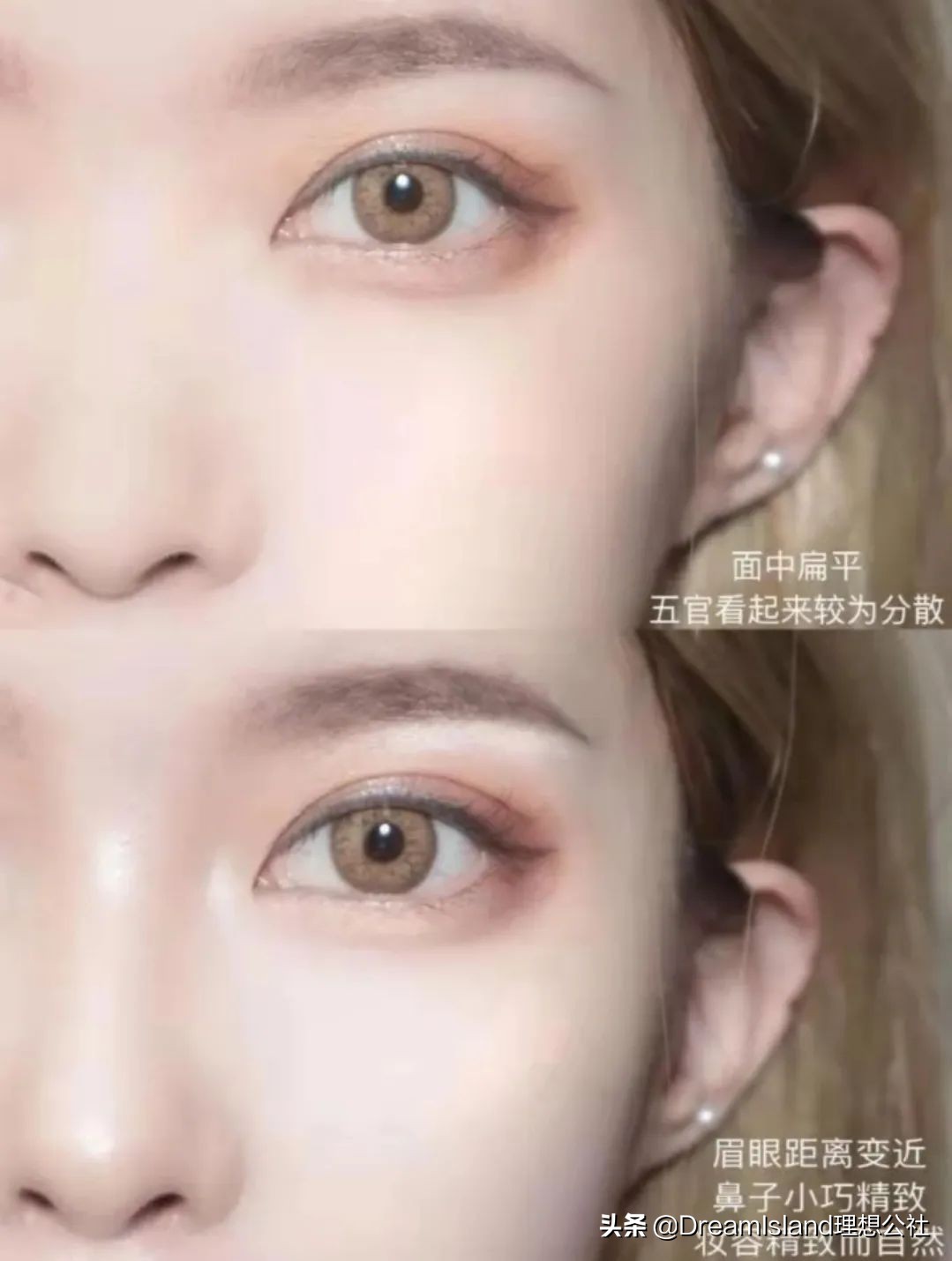 玻尿酸高光排名,打玻尿酸高光推荐