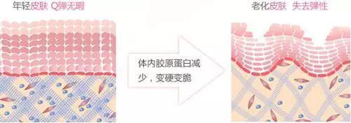 去脖子黑色素颈纹的最快方法,老年人脖子上的颈纹怎么遮挡