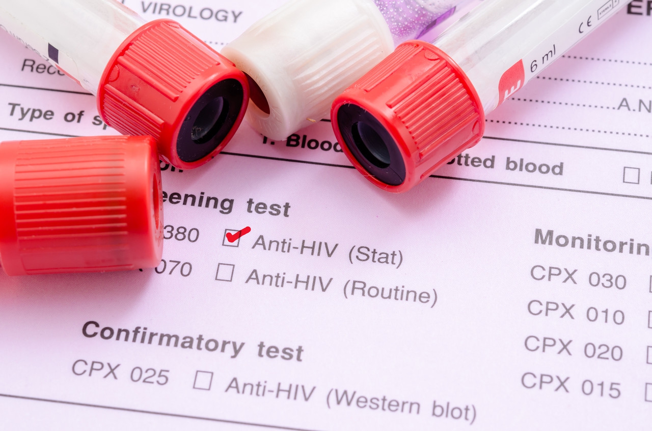 有什么方法可以治愈乙肝,全球治愈乙肝最新进展