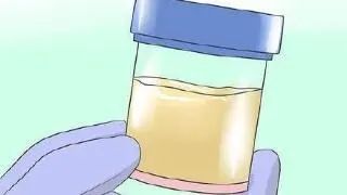 尿检结果异常？你的尿标本采集对了吗？