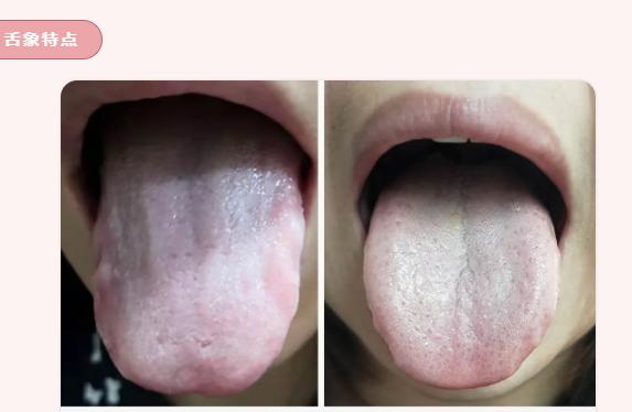 脸色暗沉如何艾灸,面色萎黄艾灸腰部