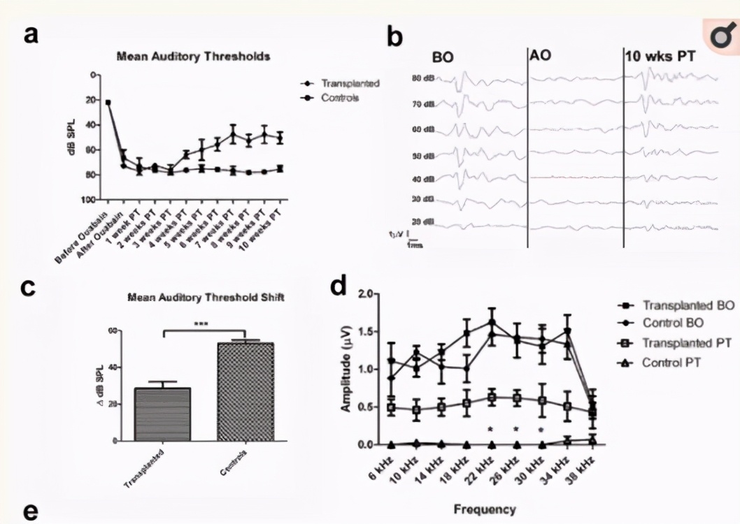 最新研究：干细胞向治疗遗传性耳聋迈进