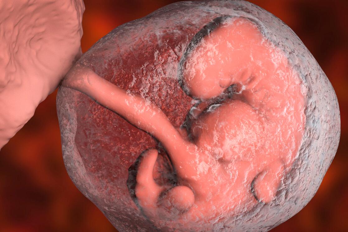 羊水和羊有关系吗,羊水为什么取名叫羊水