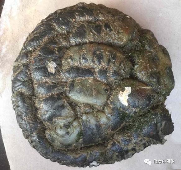 小医生抬头虎带你从“人中黄”认识神奇的中医药（下）