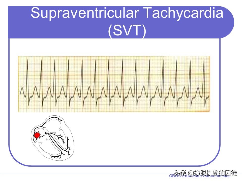 心理紧张引起心慌要紧吗,心慌是怎么回事