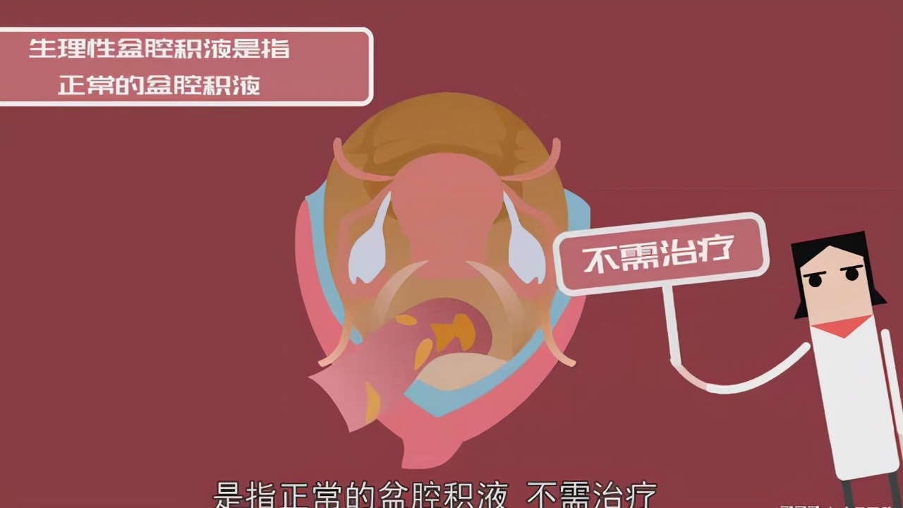 提醒广大女性：一般情况下，3种“妇科病”不用治，别太担忧