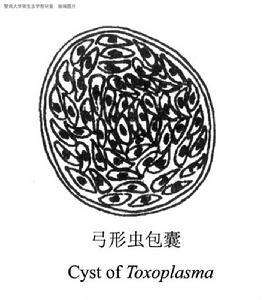 怀孕有没有受弓形虫感染怎么检查,优生五项弓形虫