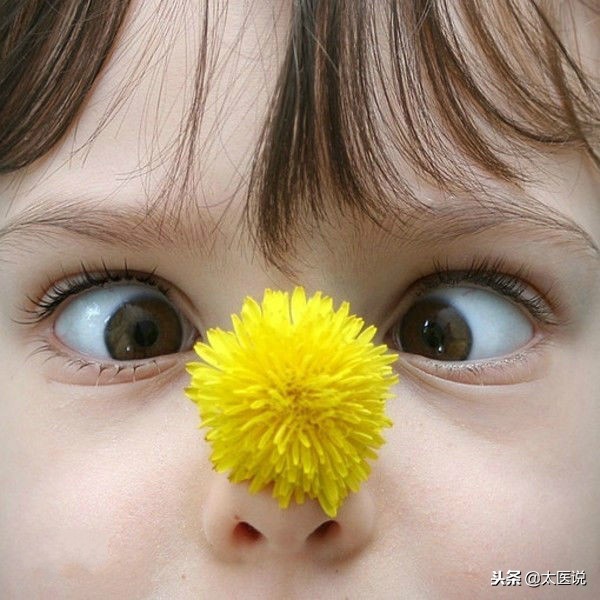 间歇性斜视做手术的危害,斜视的危害图文