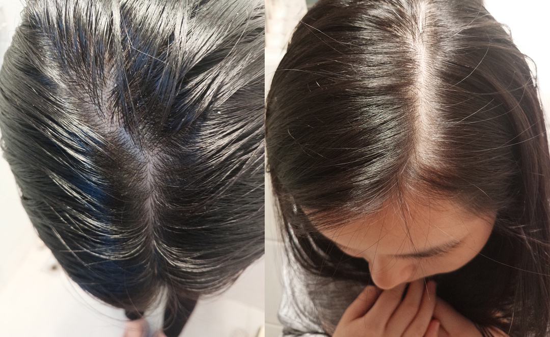 比较好用的德国防脱发,德国十大最好用的护肤品