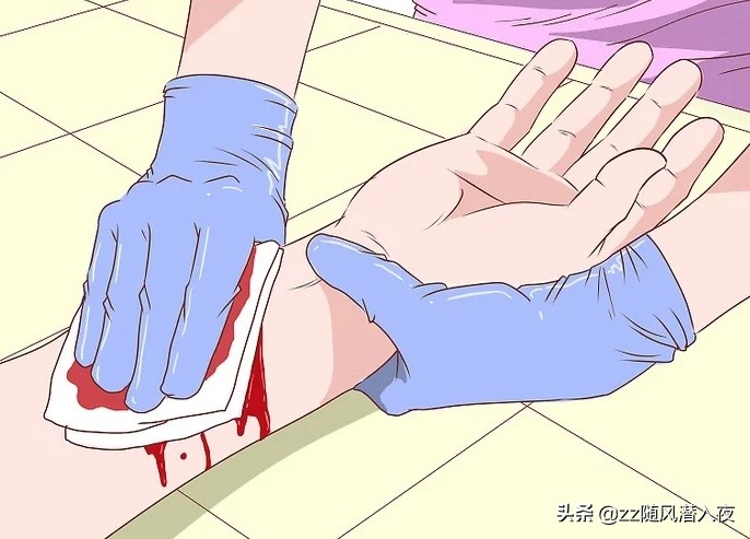 怎么处理狗咬伤口,狗咬伤口怎么处理