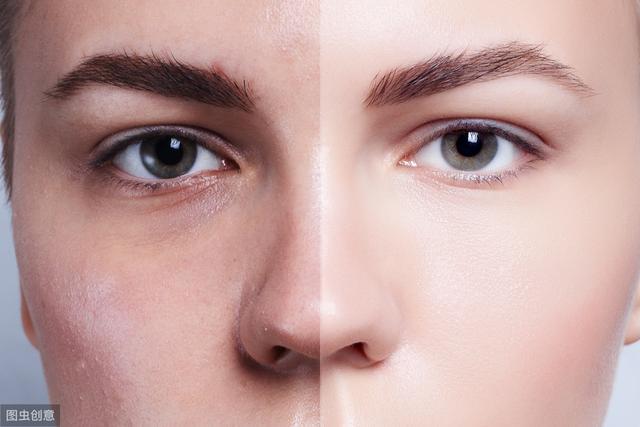 都在说买眼霜,那你的眼霜选对了没?