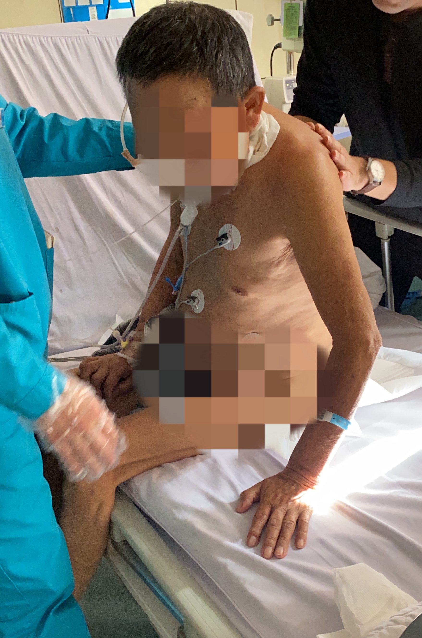 脑出血脑血栓康复小误区,脑梗死6大误区