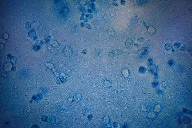 世界罕见的真菌感染,美国超级真菌是怎么回事