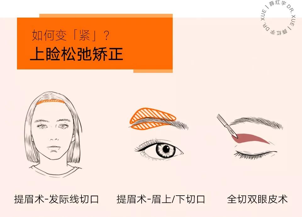 三层眼皮女人的特点,哪种眼皮最好看