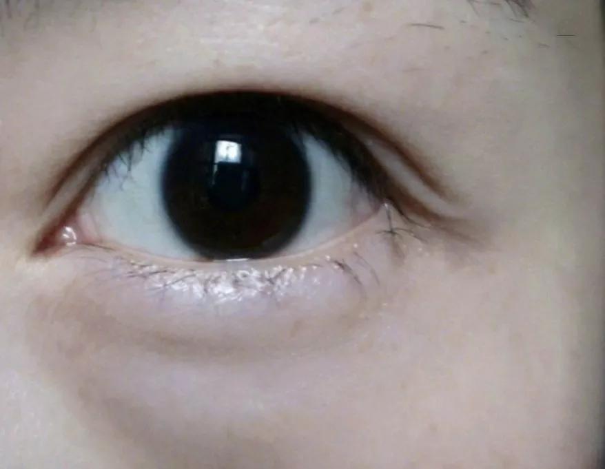 眼霜到底有没有用啊,眼霜里面有什么成分不能用