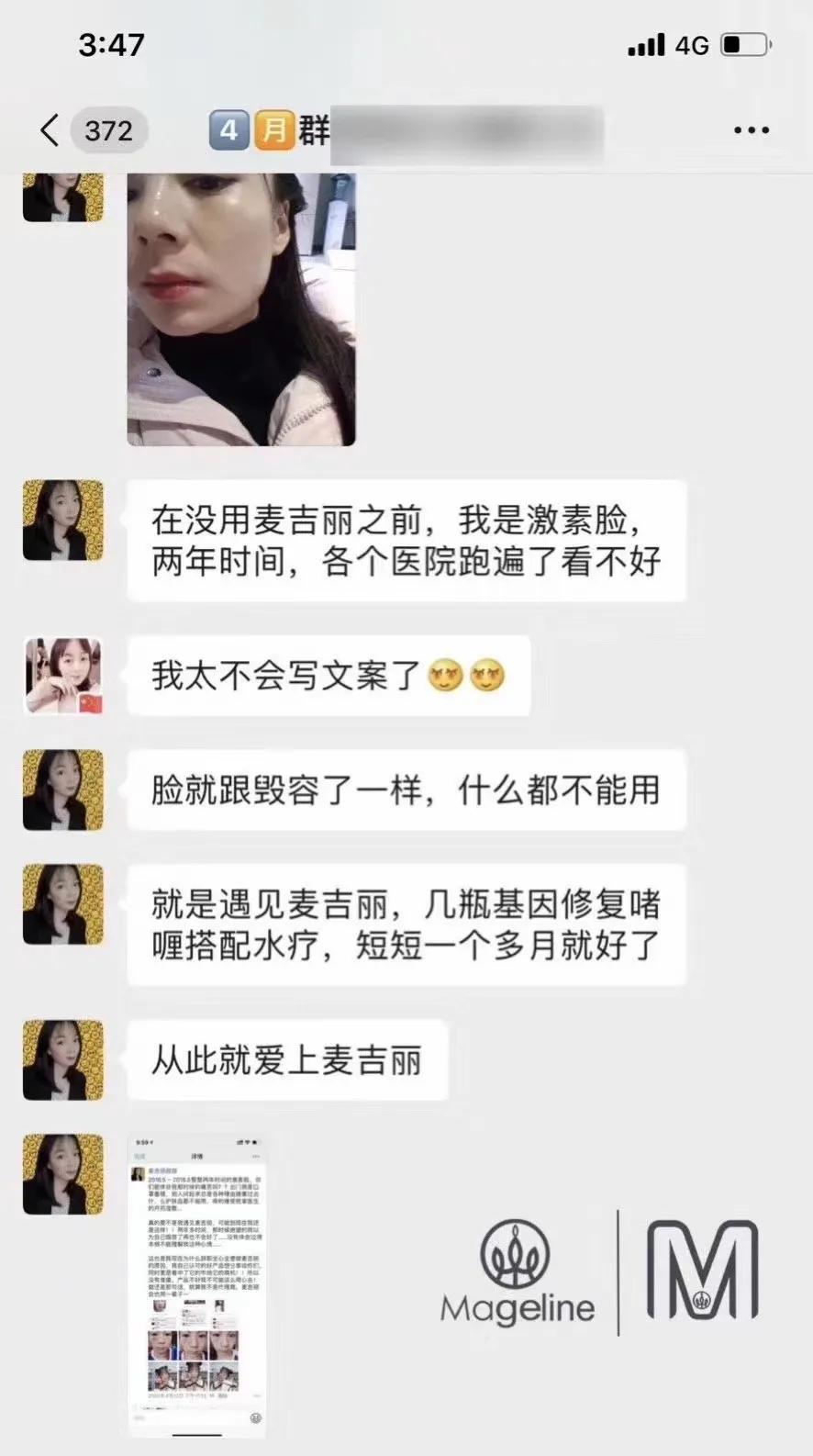 甜甜专业祛斑祛痘,甜甜祛斑直播间